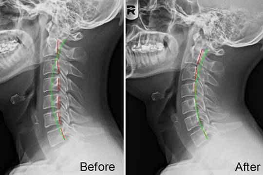 What Makes Optimal Spine Wellness Center in Plano Unique